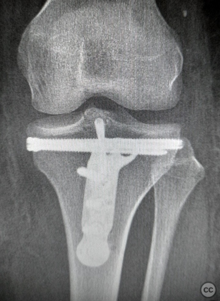 case image