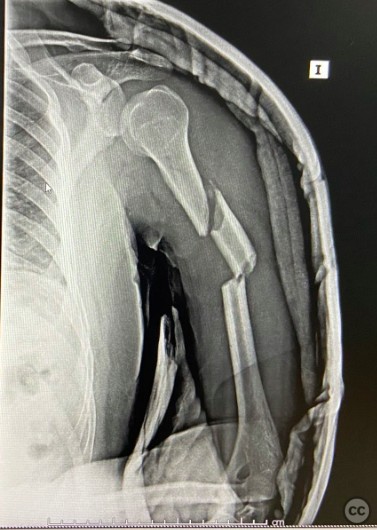 case image