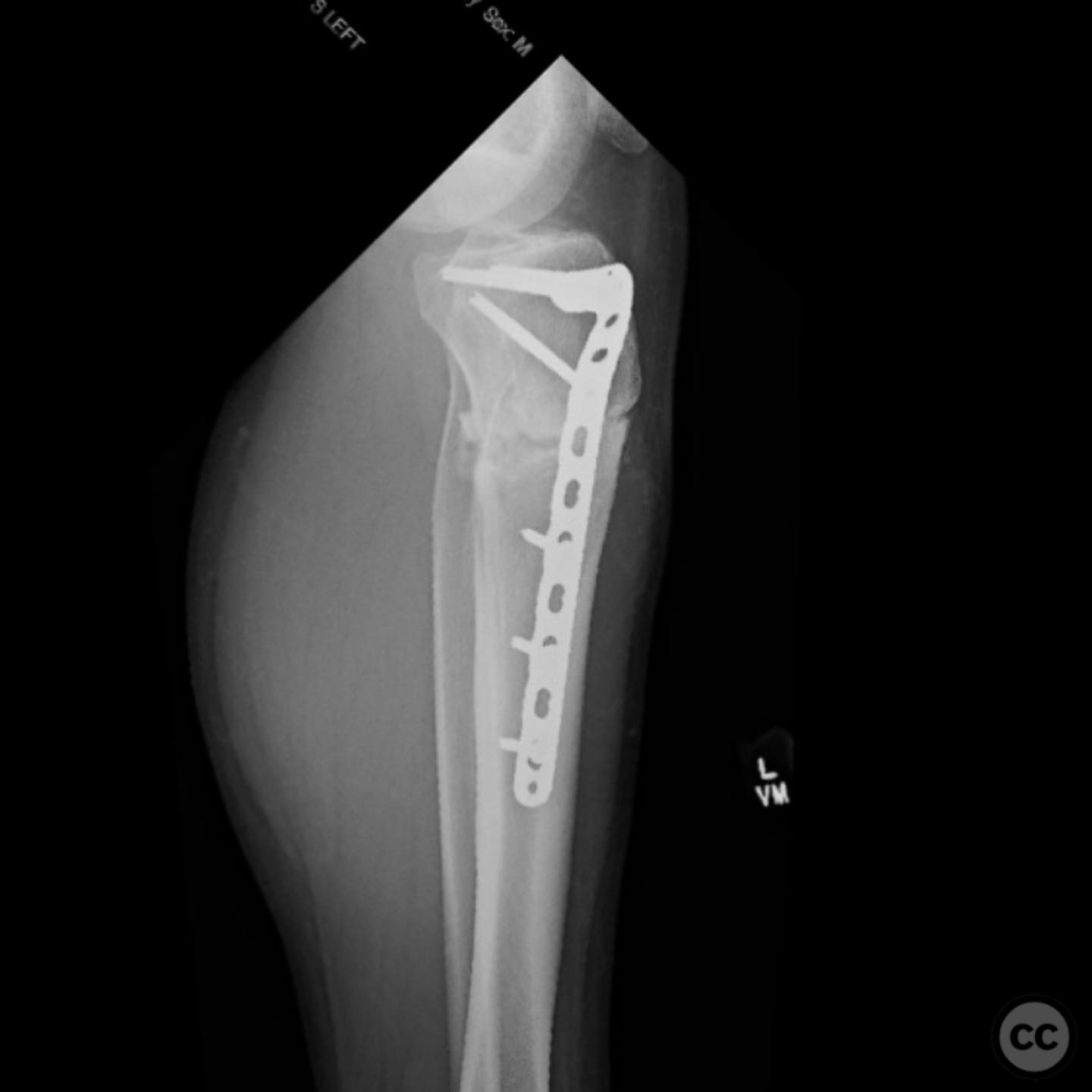 case image
