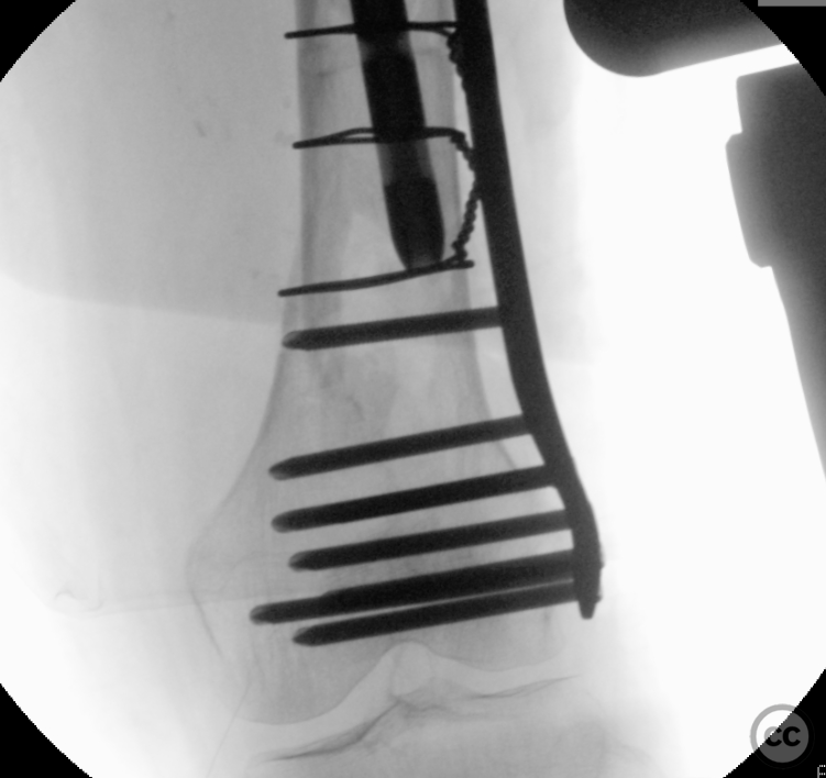 case image