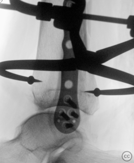 case image