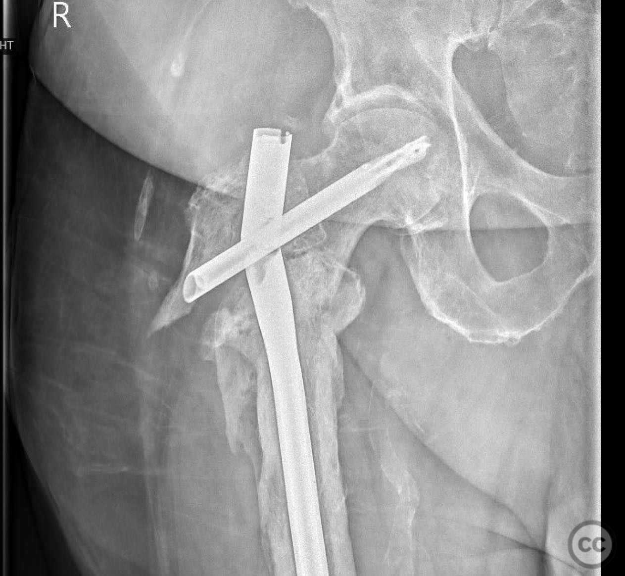 case image
