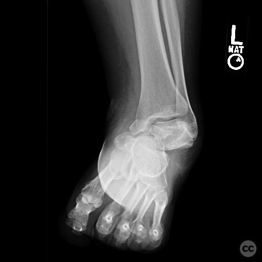 case image