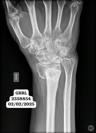 case image