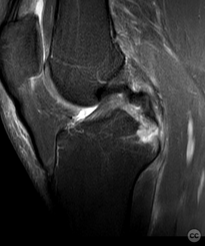 case image