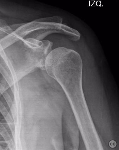 case image