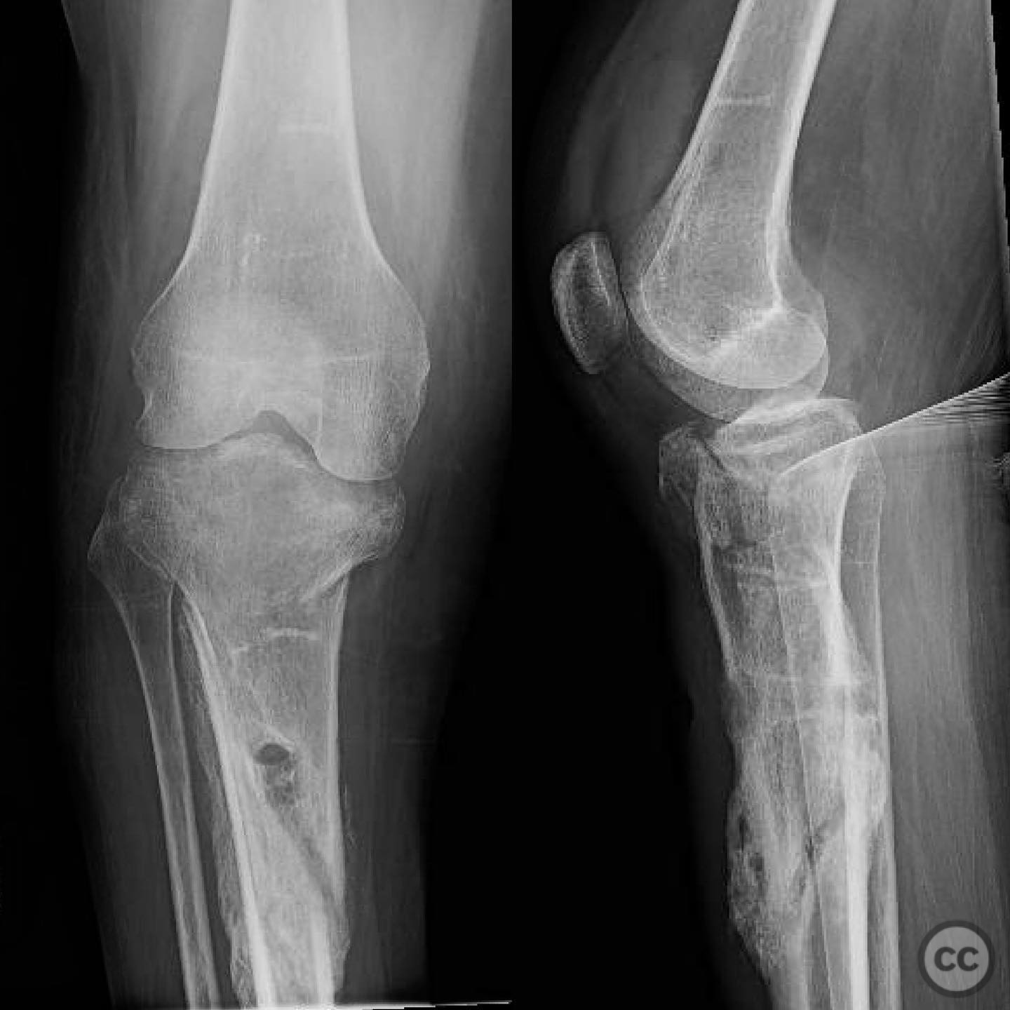 case image