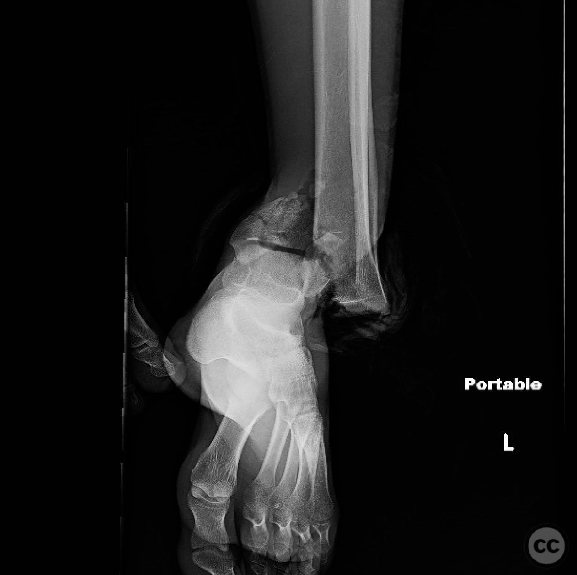 case image