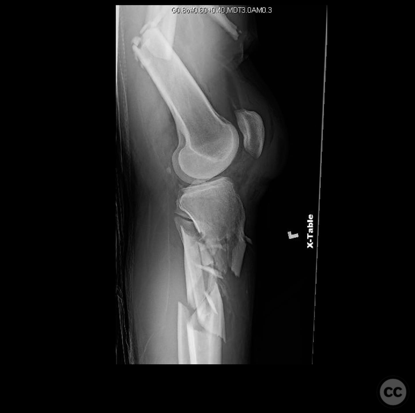 case image