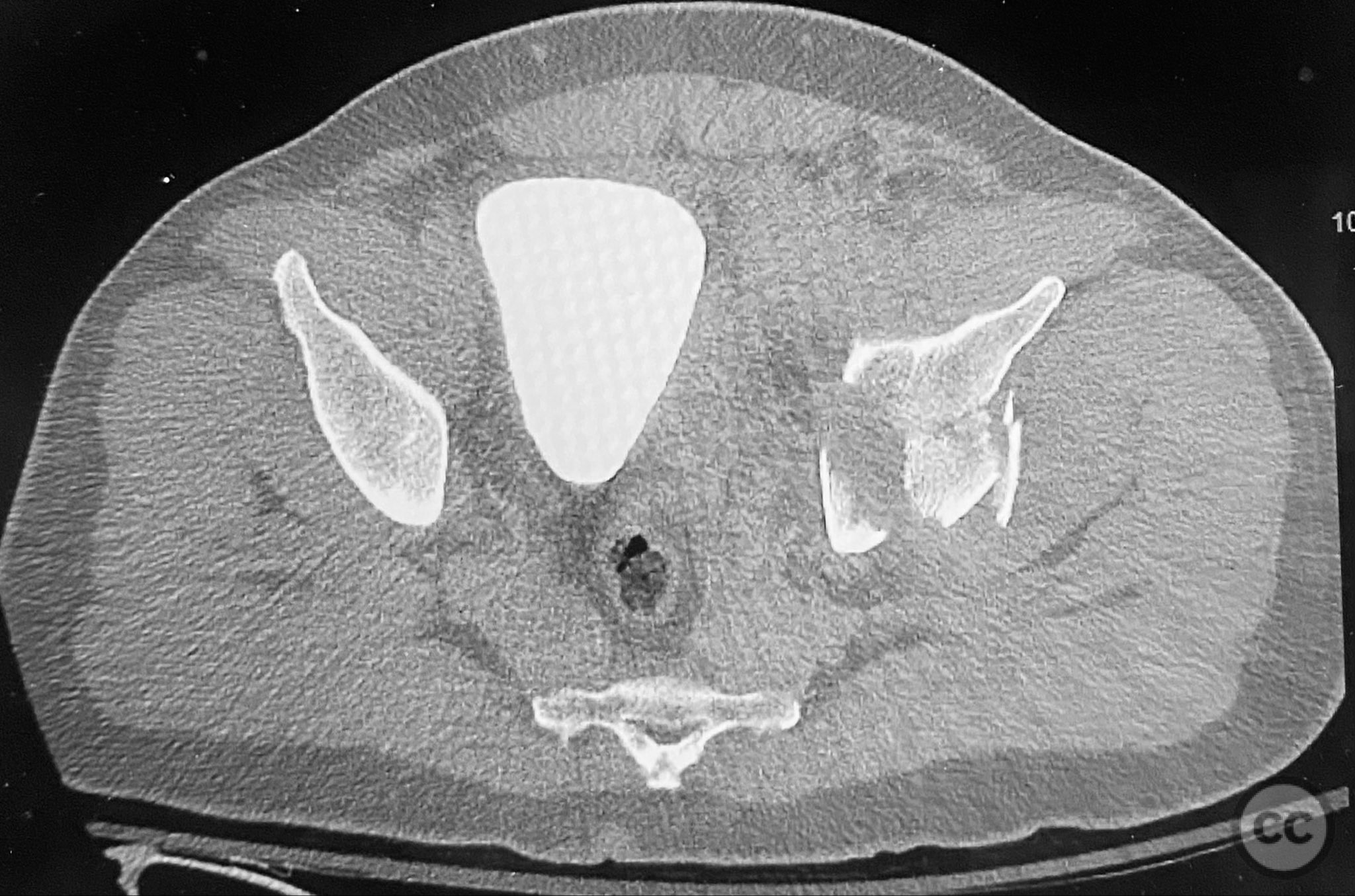 case image