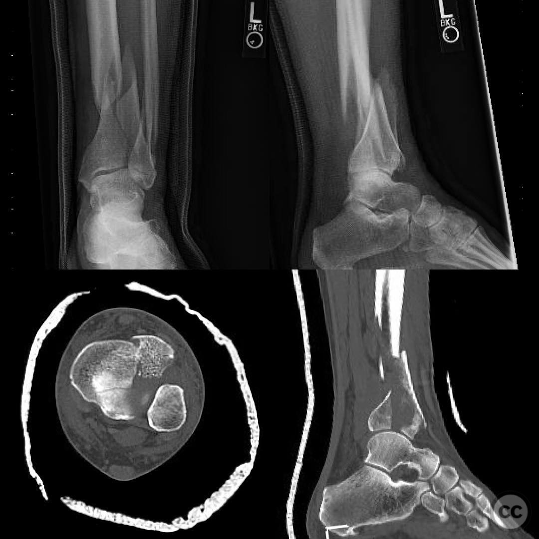 case image