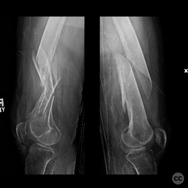case image