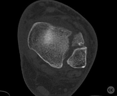 case image