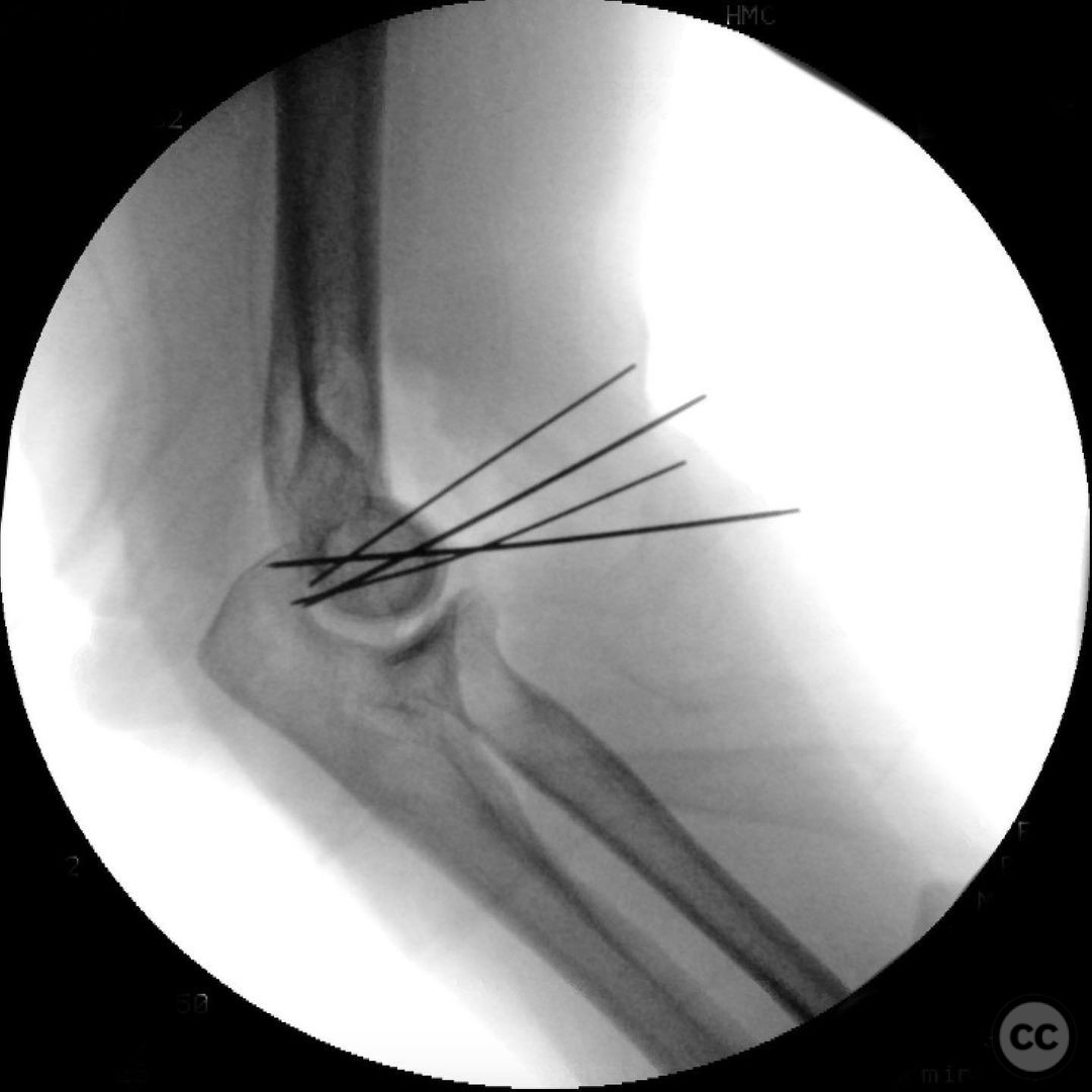 case image