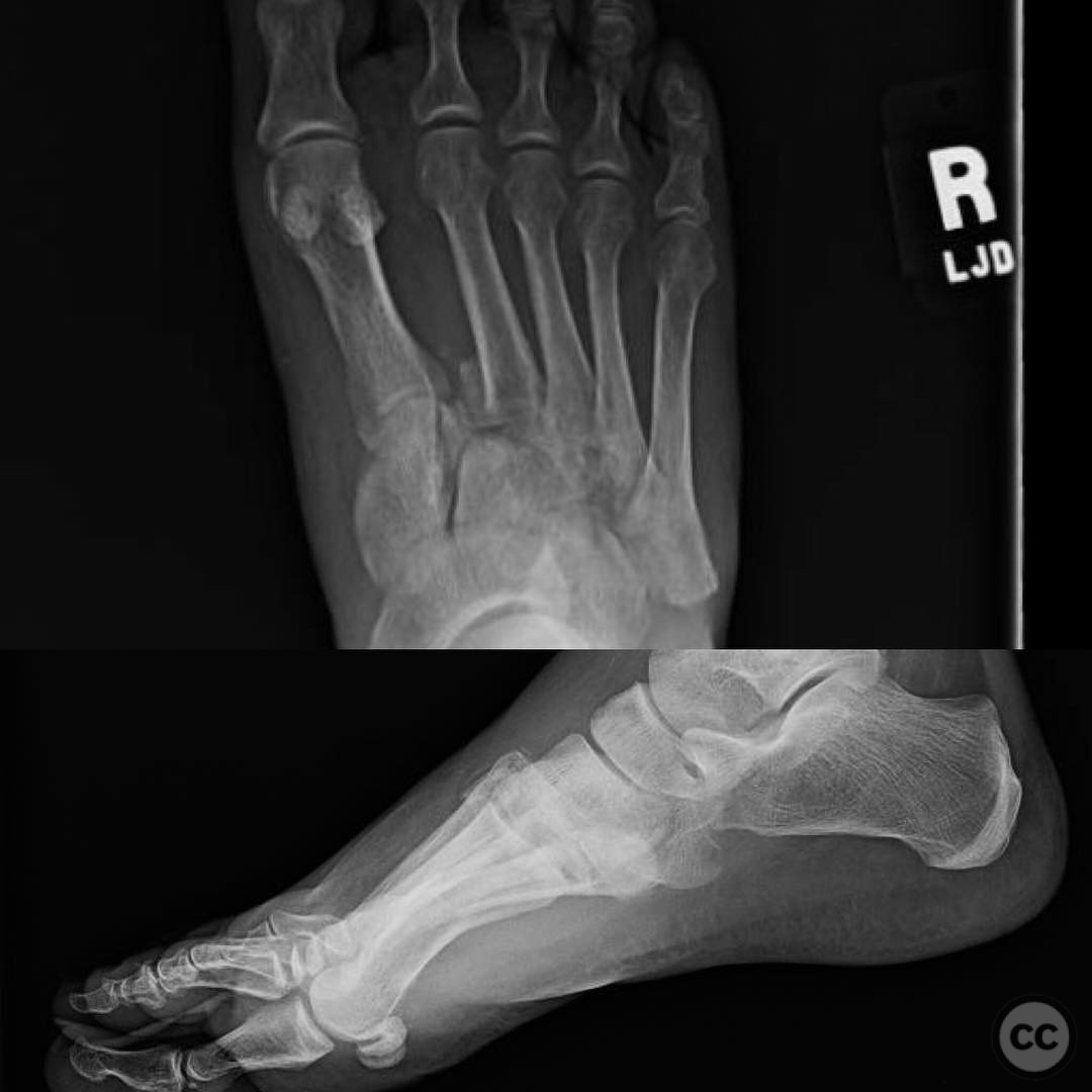 case image