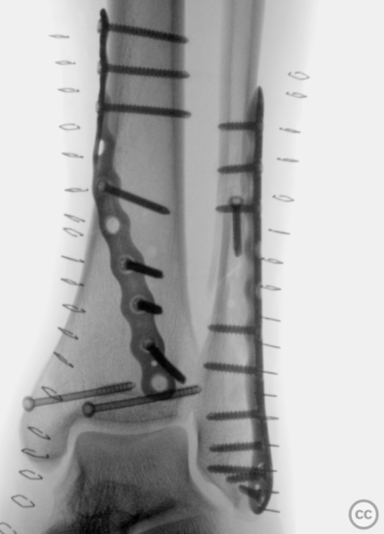 case image