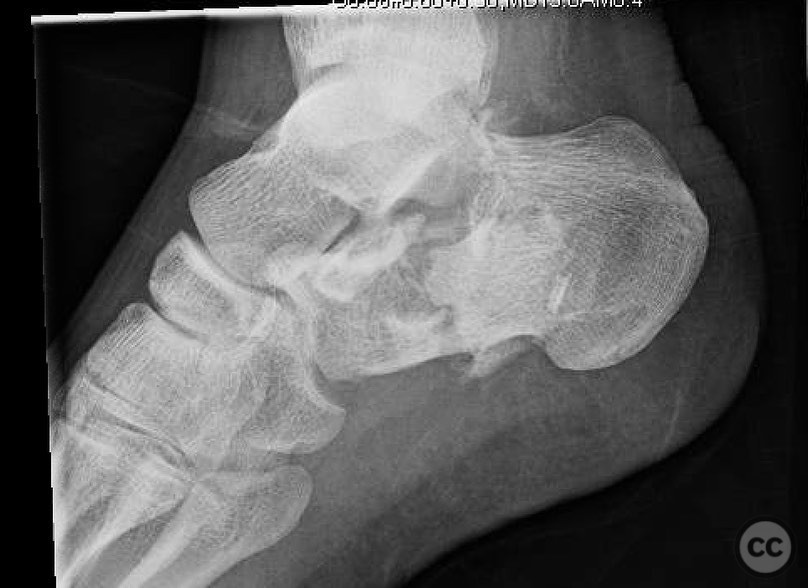 case image