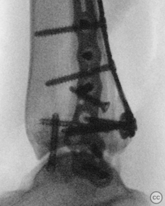 case image