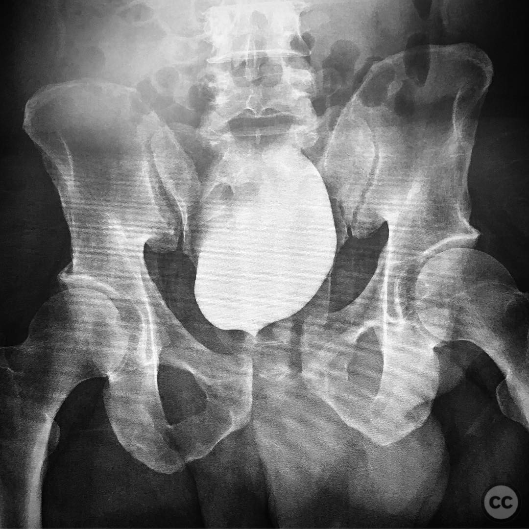 case image