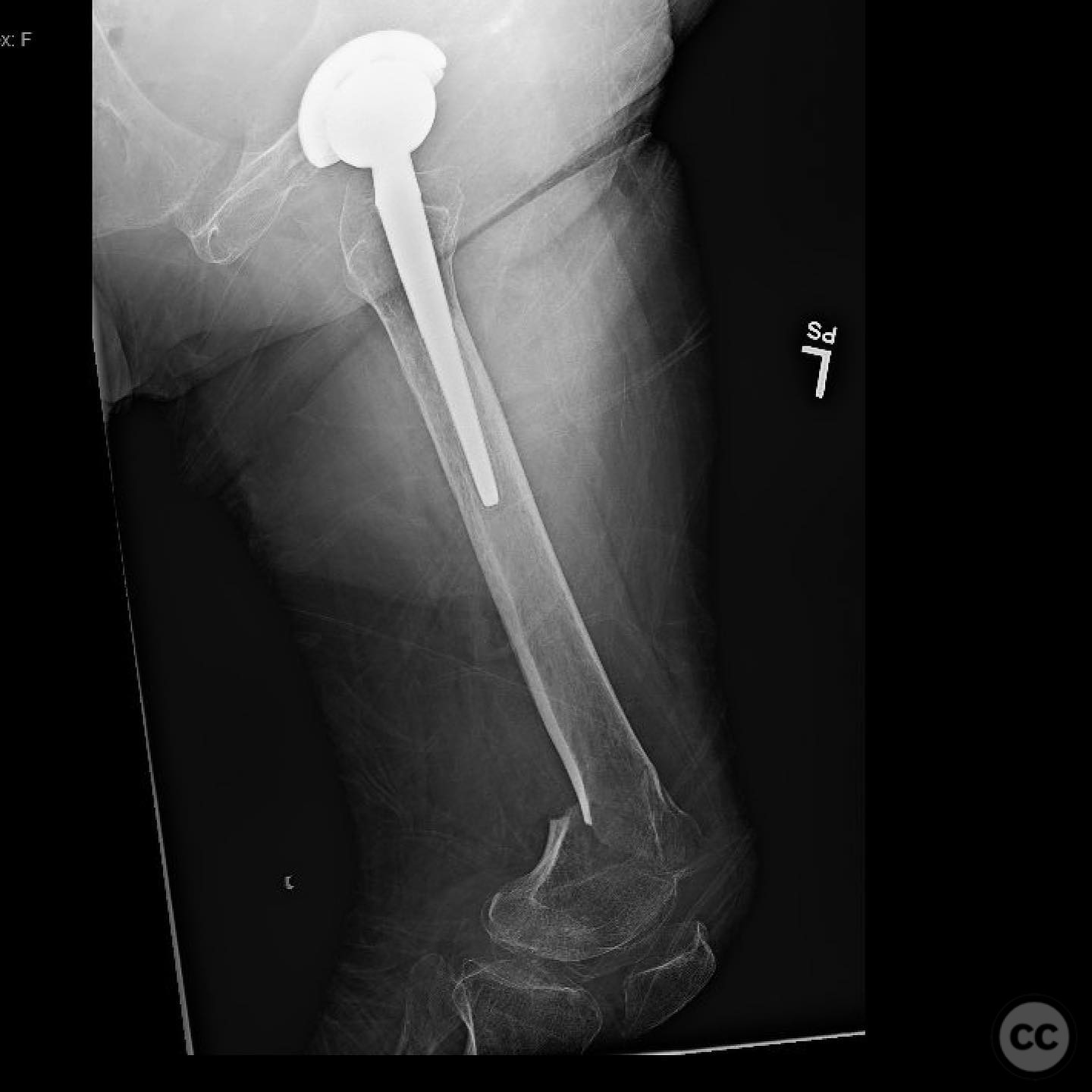 case image
