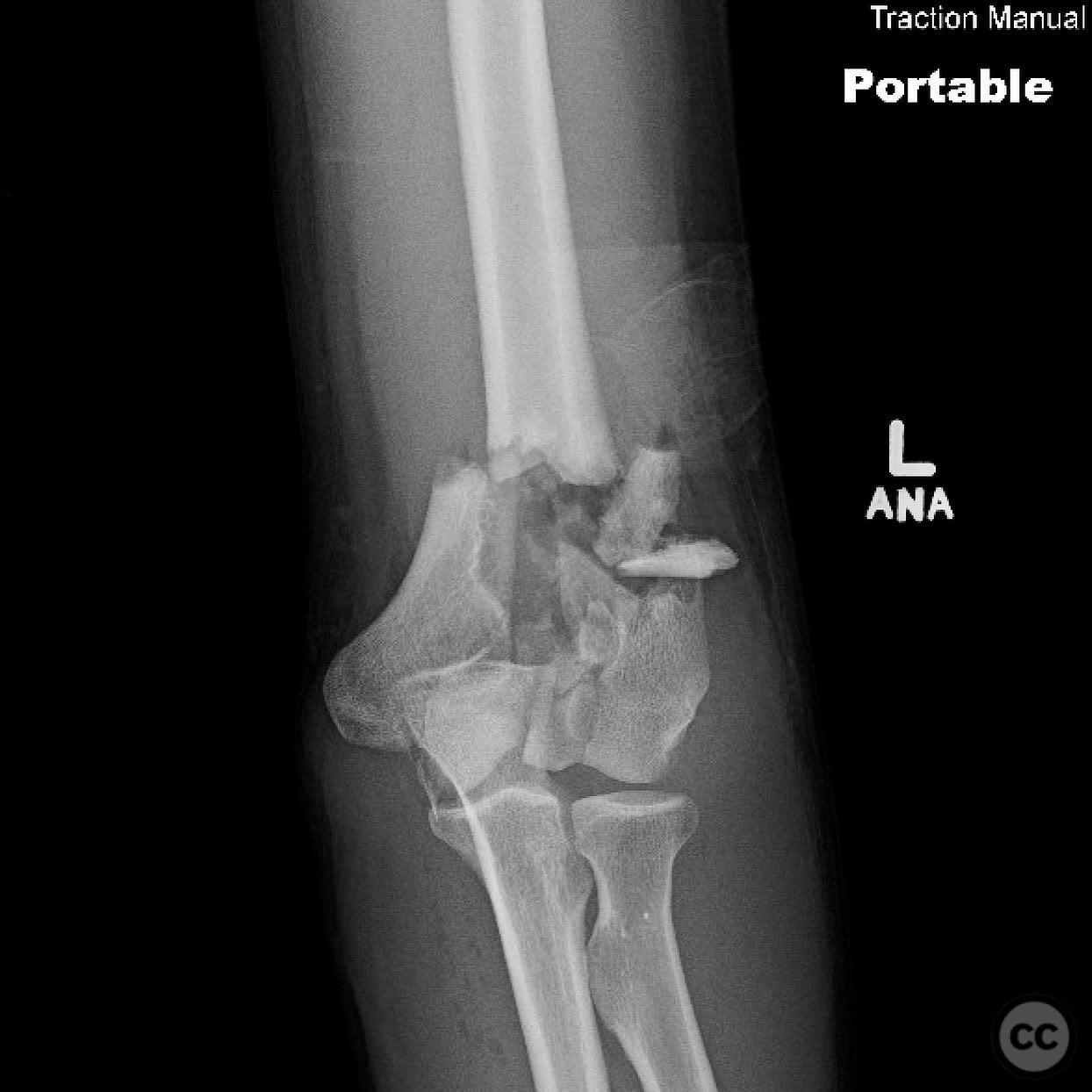 case image