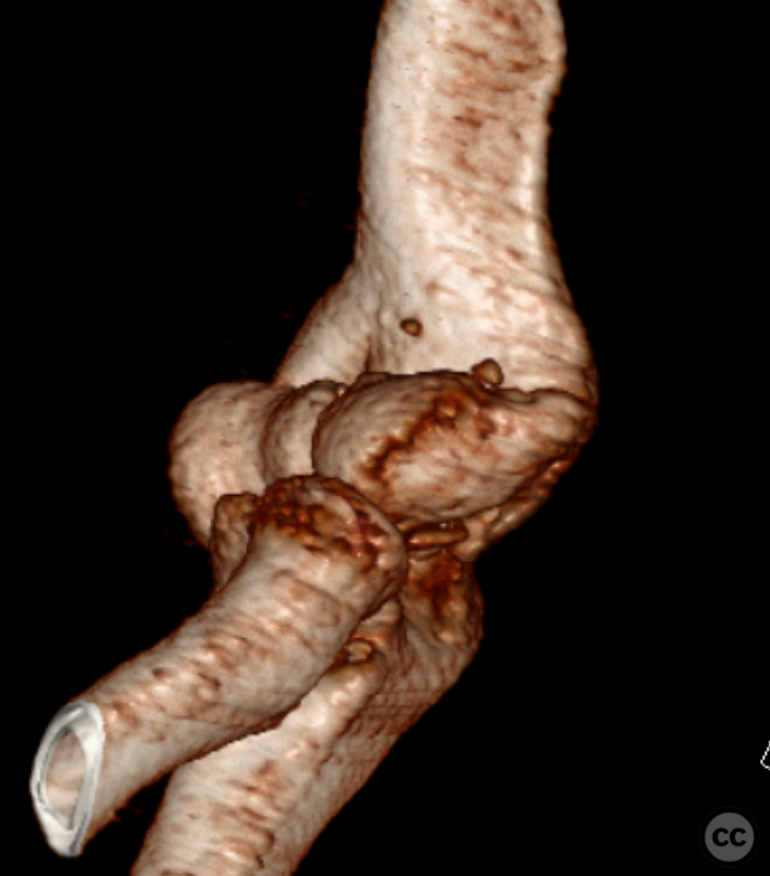 case image