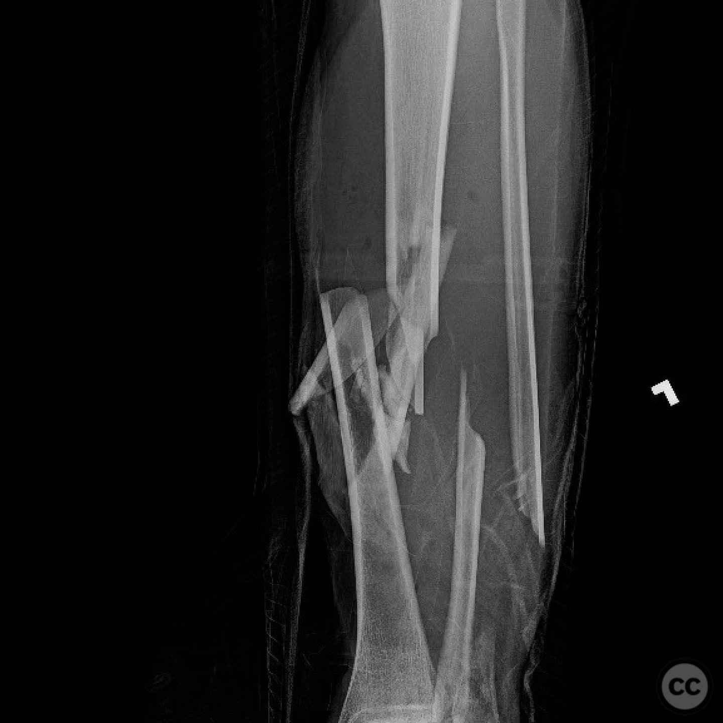 case image