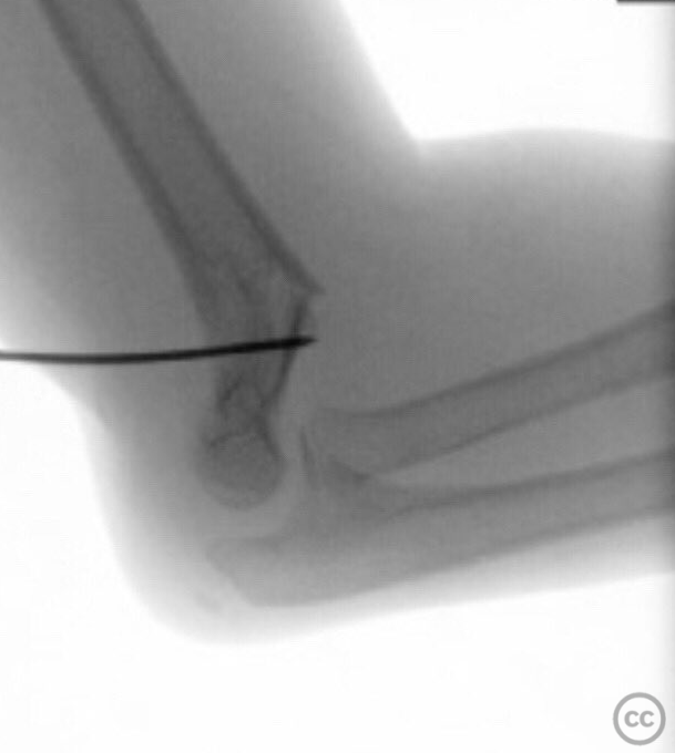 case image