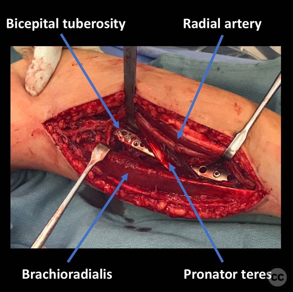 case image