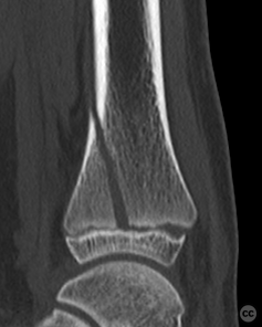 case image