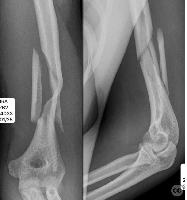 case image