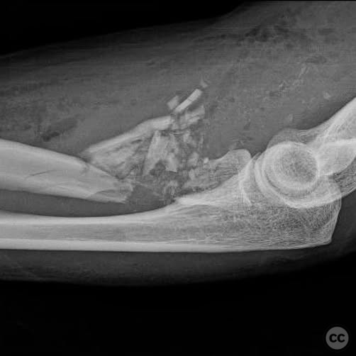 case image