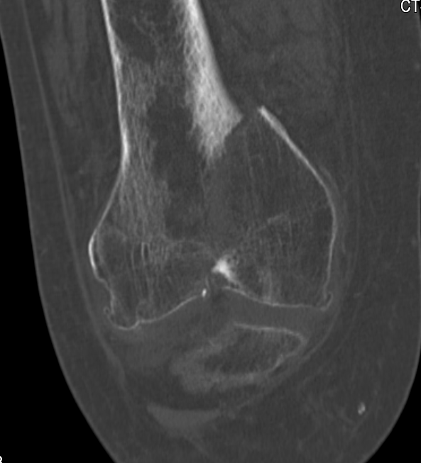 case image