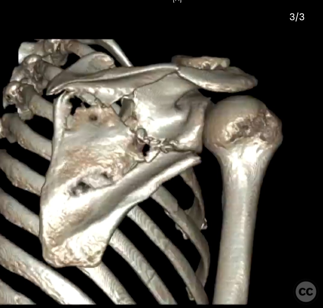 case image