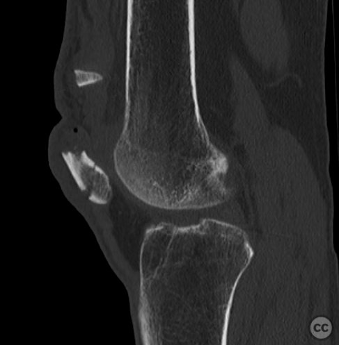 case image