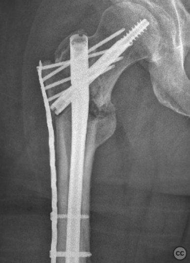 case image
