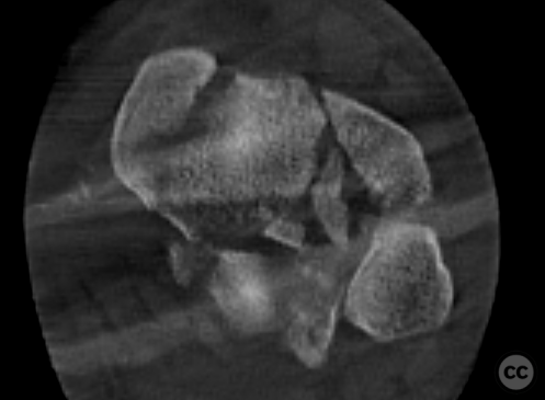 case image