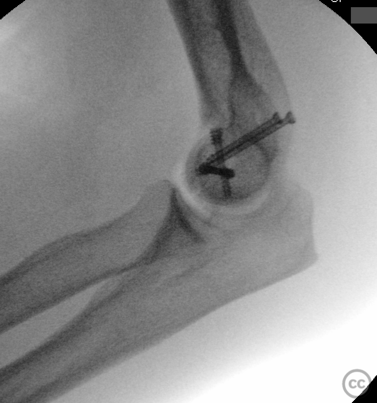 case image