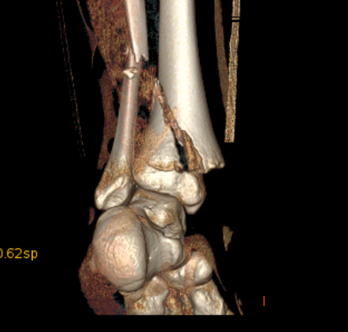 case image
