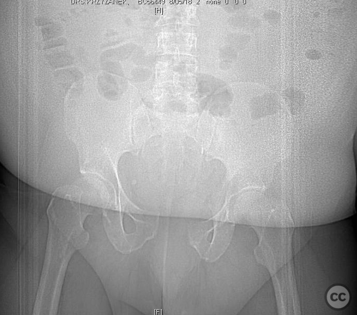 case image