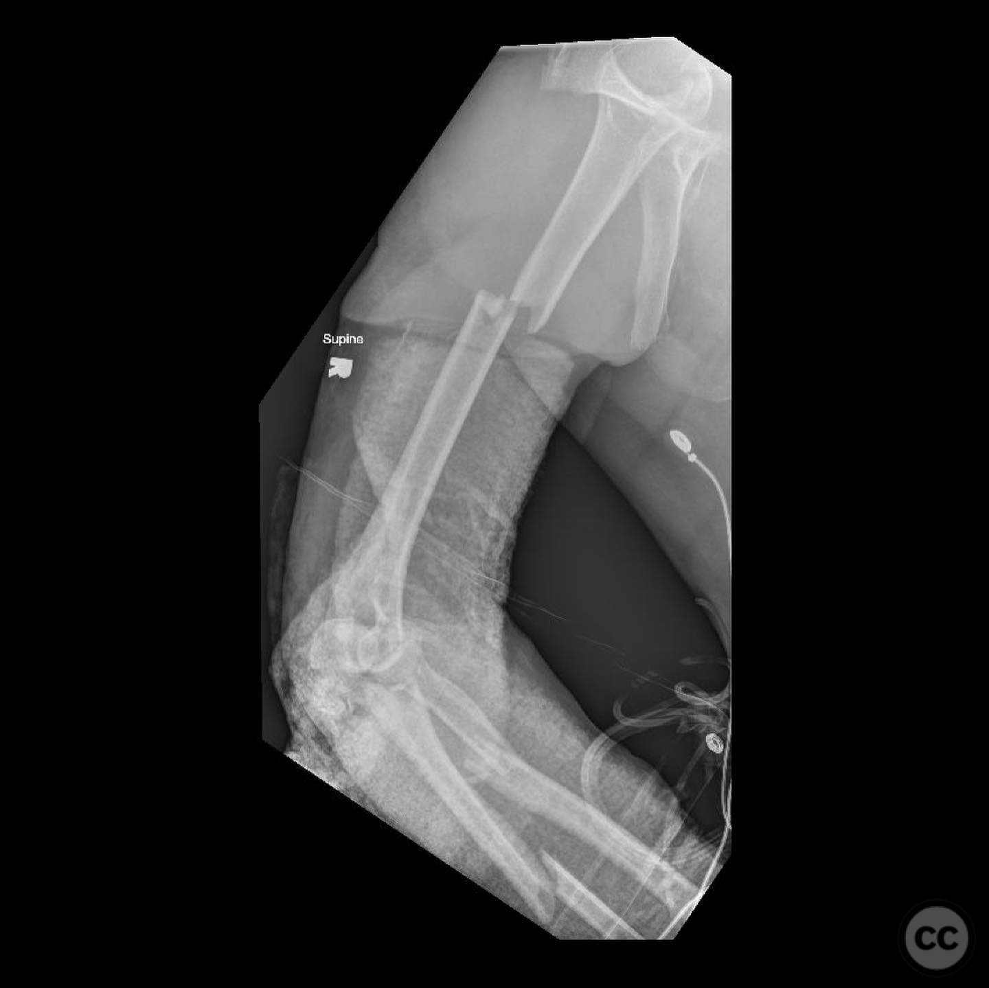 case image