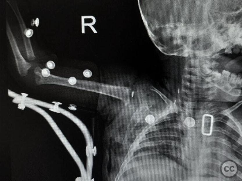case image