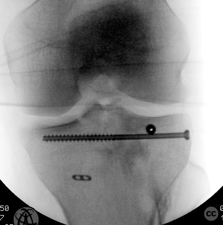 case image