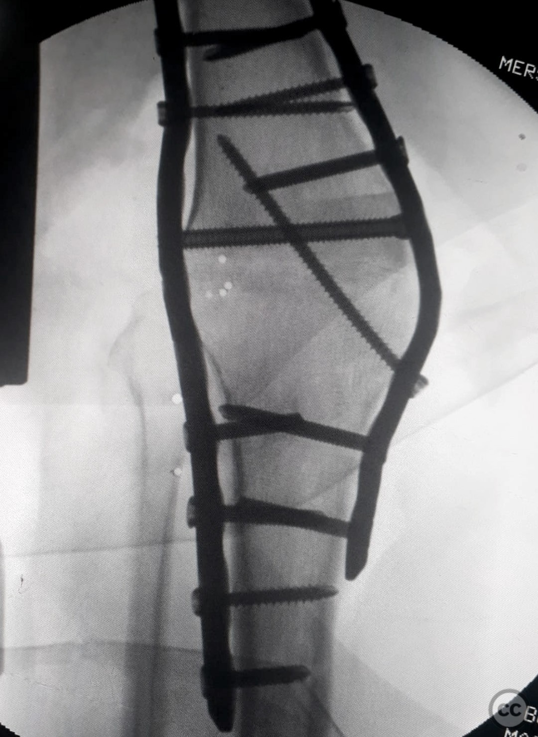 case image