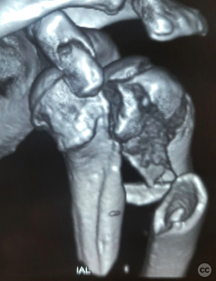 case image