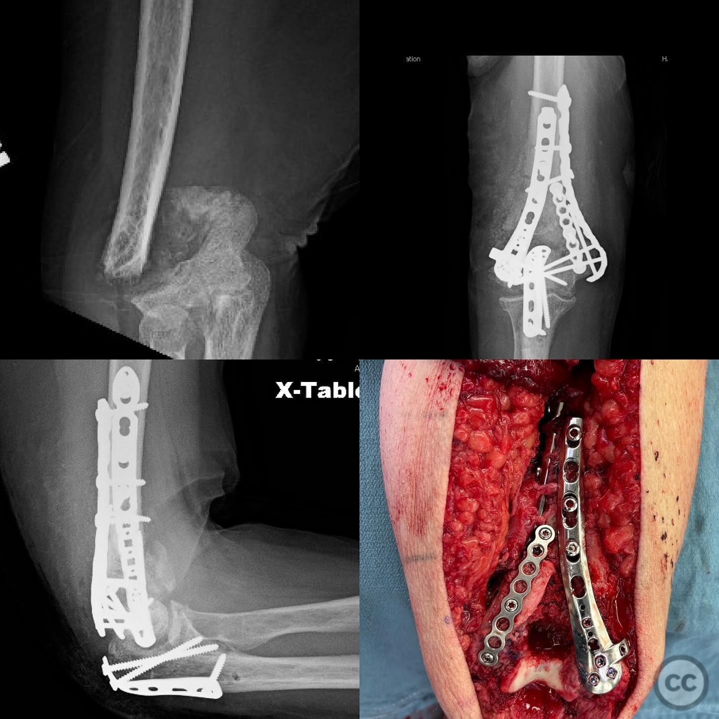 case image