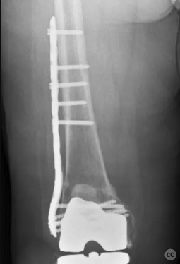 case image