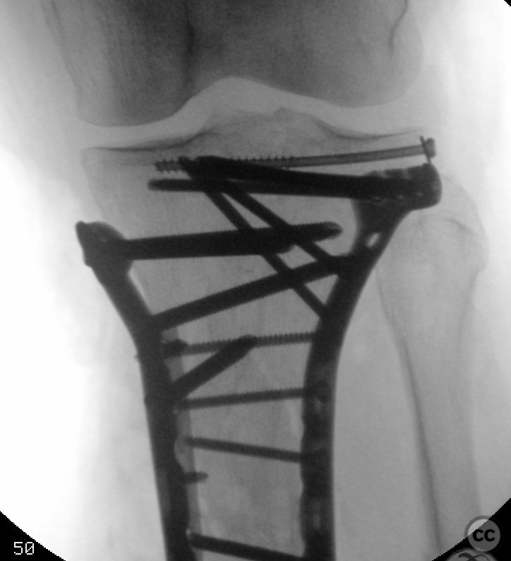 case image