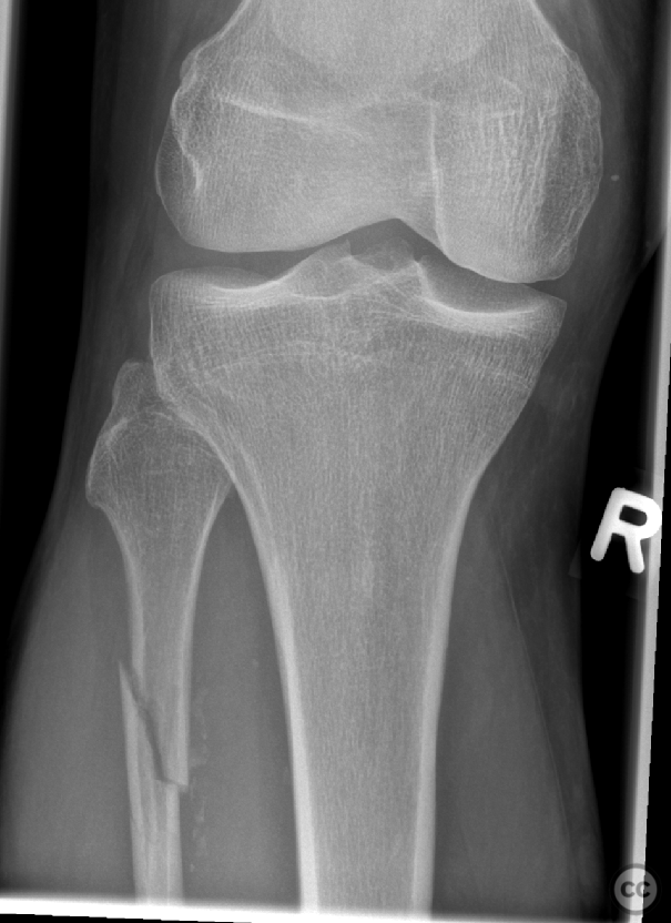 case image