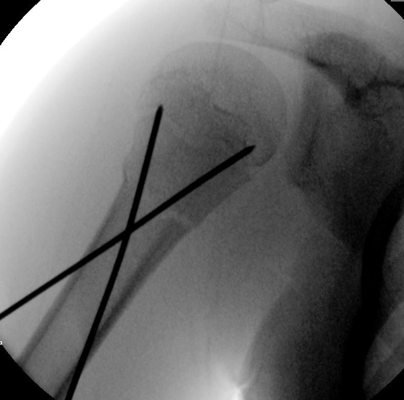 case image